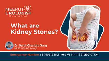 What are Kidney Stones - Dr Shaleen Sharma Video