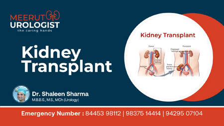 The Gift of Life: Understanding Kidney Transplants with Dr. Shaleen Sharma Video